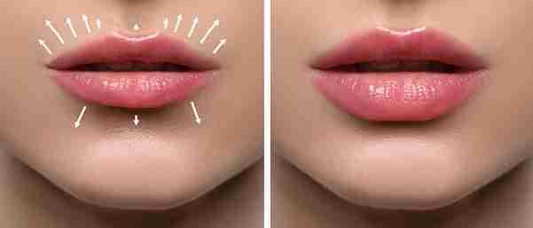 Image Source - Private Dentist lisburn