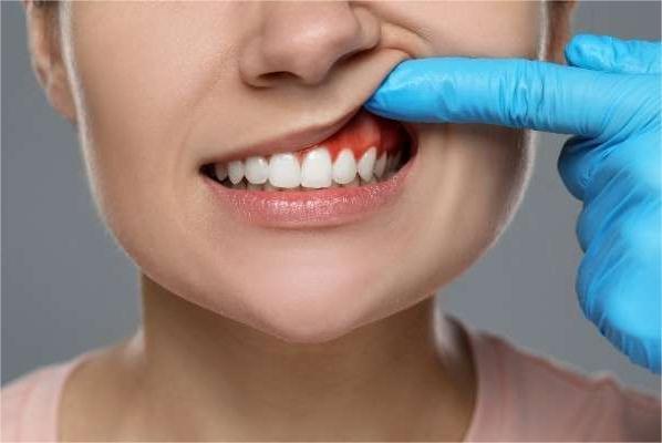  dental implant Birmingham