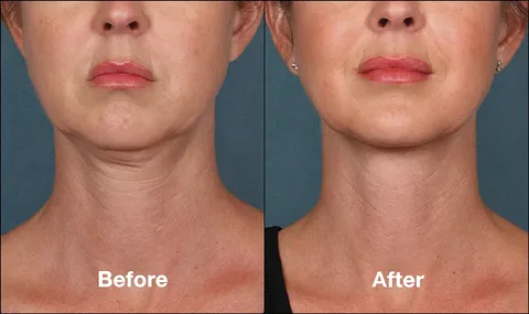 Sngine 01bb30a2990b1faaad73f779f18567a2