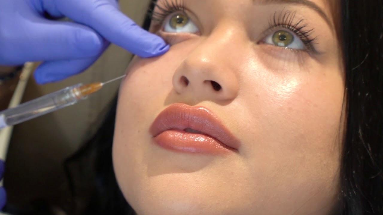 Sngine 3950d920f824bc000d24dd58415fea81