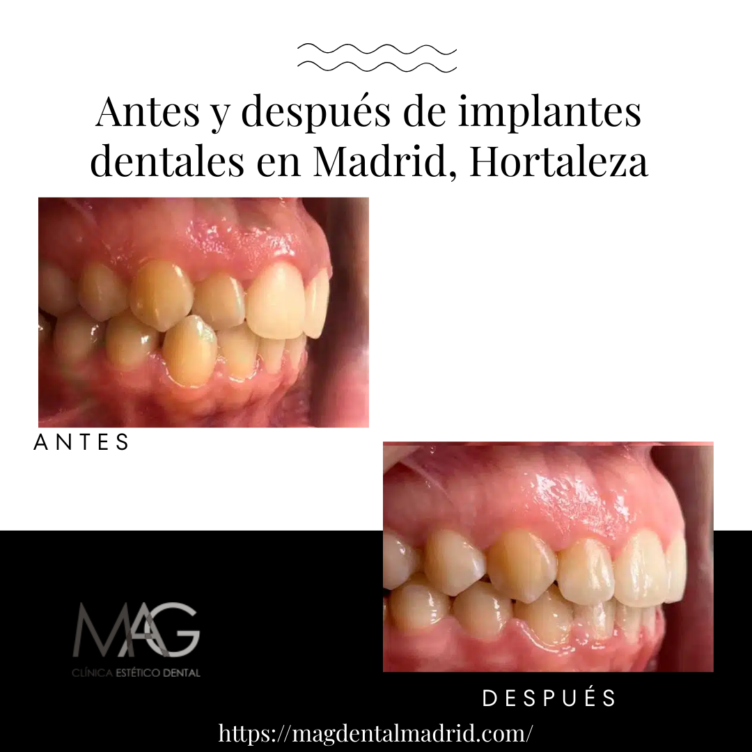 Sngine 3e015641e9017cf1da38607ee0c0030e