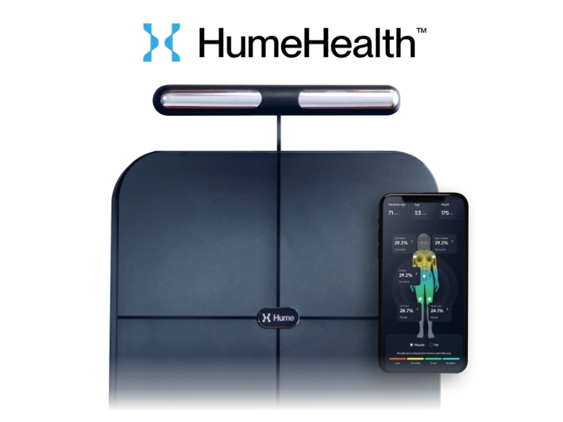 Sngine 57145a17b57f1a6ec154fc3a36cdc58b