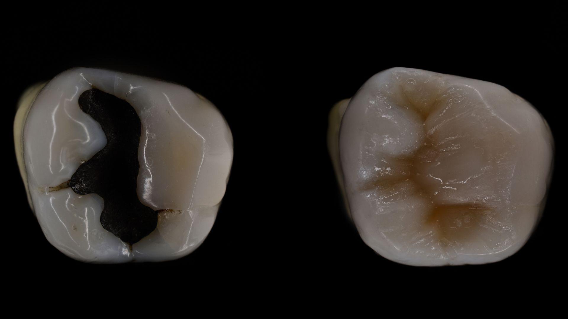 Sngine 9554a62d71984e81b57e69044d11ae6c