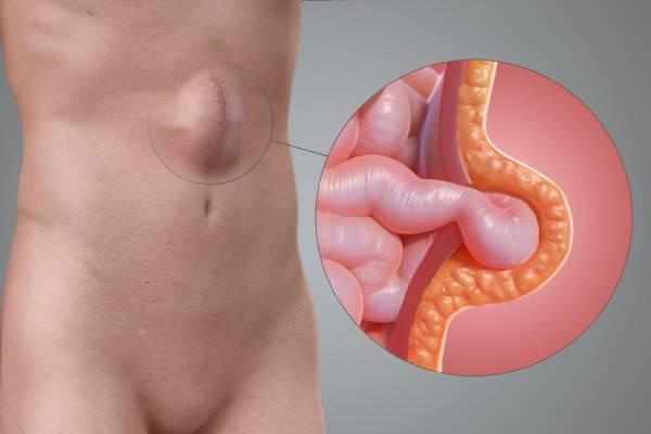 Sngine A0da0951650aad0733a0b8e199349ebf