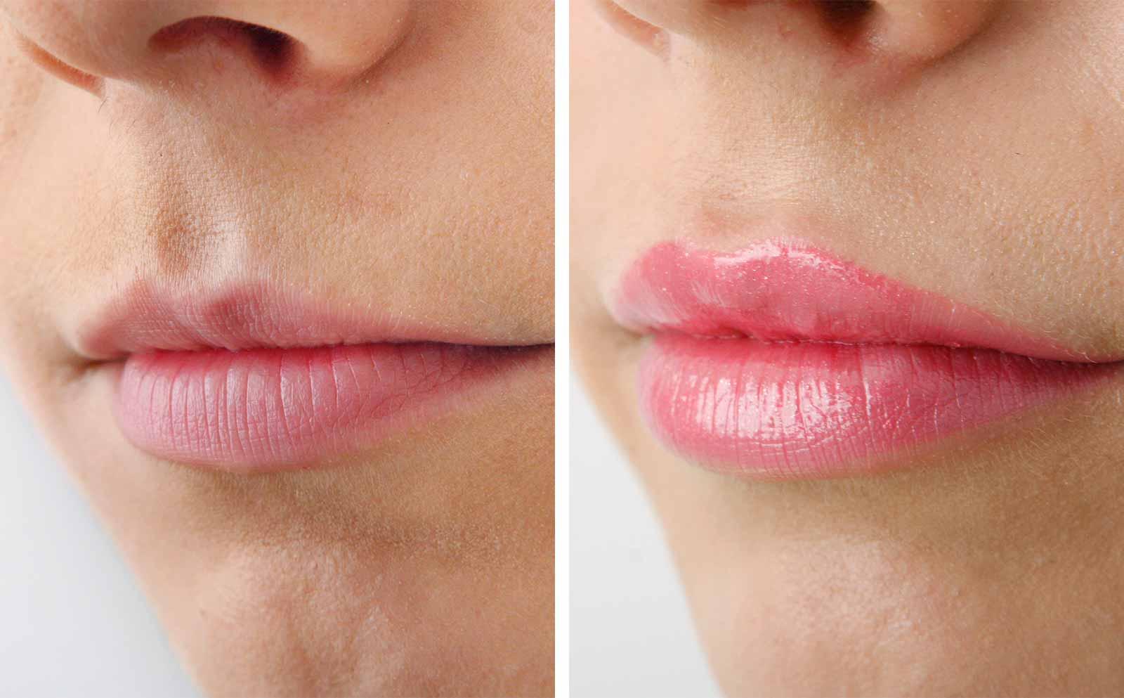 Sngine Aeb7021b299fe3dc0a33a3ff6bbf172a