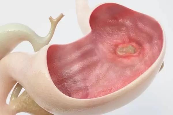 Sngine B9e8bf9e3d224fe05cf10fb59f16075b