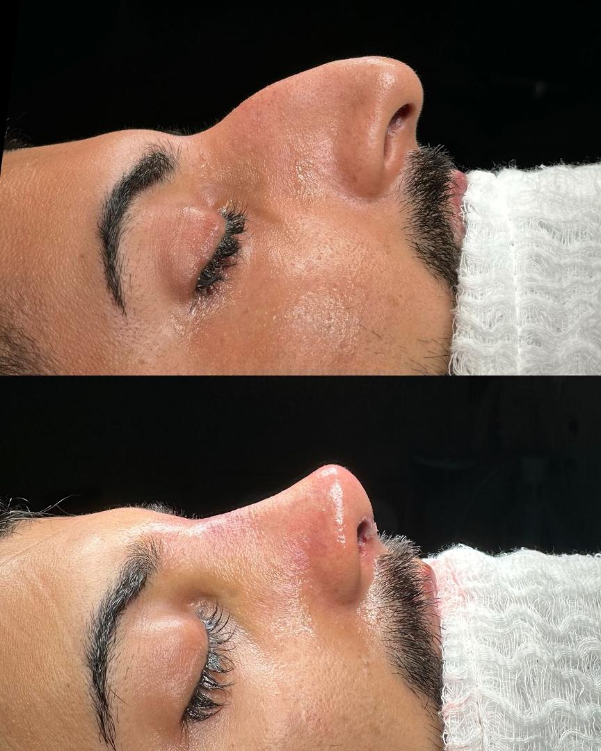 Sngine E0b2400f08c146a0234ddd80837314cd