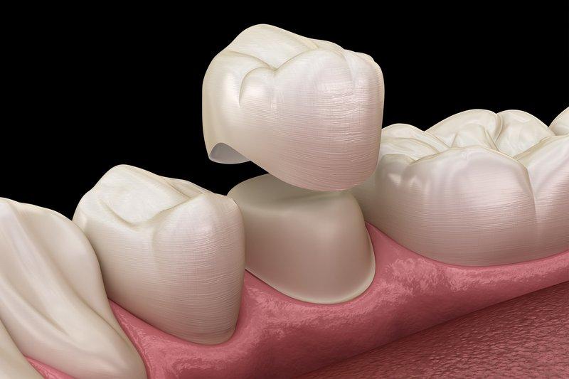 Sngine F55566ab78e31f15c1c174b30e0f3f17